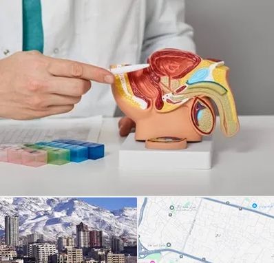 دکتر اورولوژی در ازگل