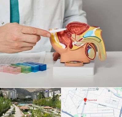 دکتر اورولوژی در بلوار تعاون