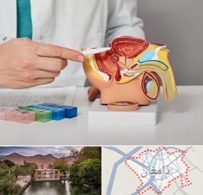 دکتر اورولوژی در دامغان
