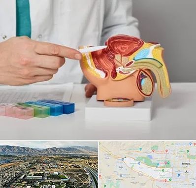 دکتر اورولوژی در منطقه 21 تهران 