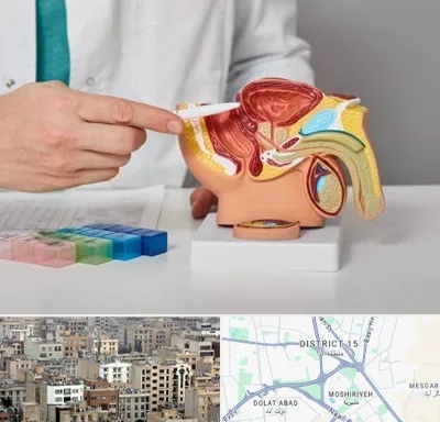 دکتر اورولوژی در جنوب شرق تهران