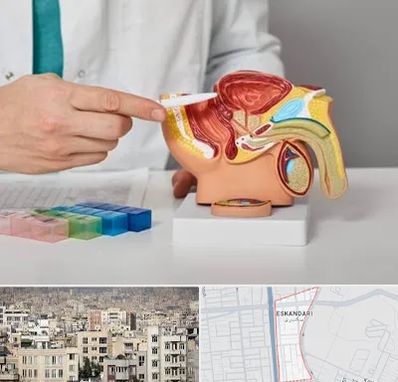 دکتر اورولوژی در اسکندری