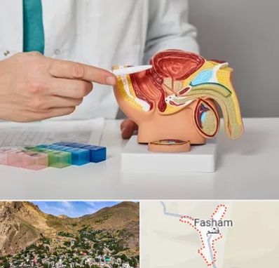 دکتر اورولوژی در فشم