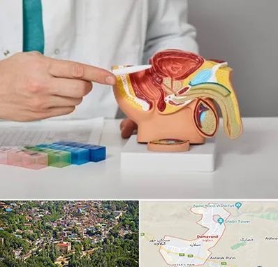 دکتر اورولوژی در دماوند