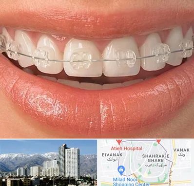 ارتودنسی اقساطی در شهرک غرب 