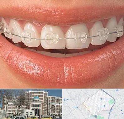 ارتودنسی اقساطی در طلاب مشهد