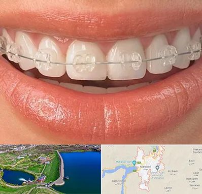 ارتودنسی اقساطی در مهاباد