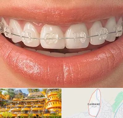 ارتودنسی اقساطی در دربند