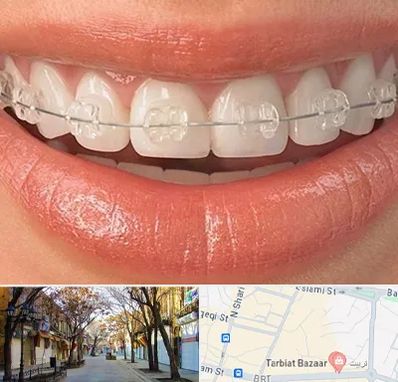 ارتودنسی اقساطی در تربیت تبریز
