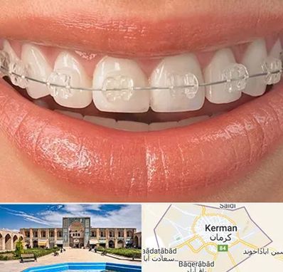 ارتودنسی اقساطی در کرمان