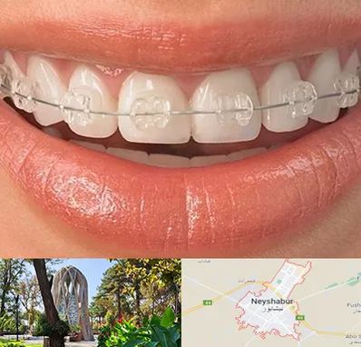 ارتودنسی اقساطی در نیشابور