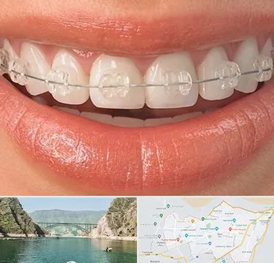 ارتودنسی اقساطی در ایلام