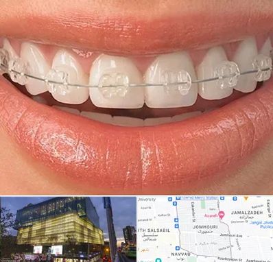 ارتودنسی اقساطی در جمهوری 