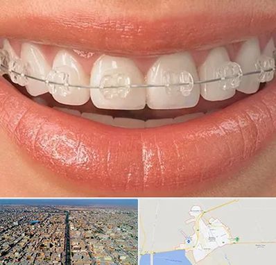 ارتودنسی اقساطی در بندر ماهشهر