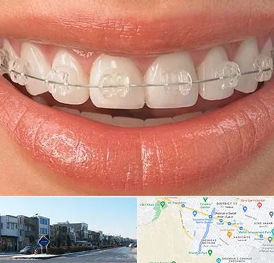 ارتودنسی اقساطی در شریعتی مشهد 