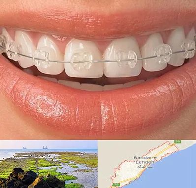 ارتودنسی اقساطی در بندرلنگه