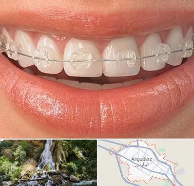 ارتودنسی اقساطی در الیگودرز