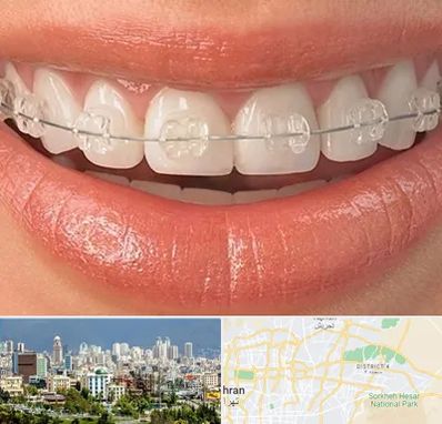ارتودنسی اقساطی در شرق تهران 