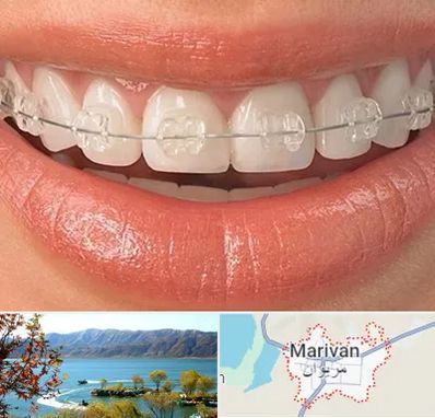 ارتودنسی اقساطی در مریوان