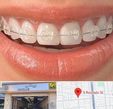 ارتودنسی اقساطی در رودکی