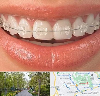 ارتودنسی اقساطی در قدوسی غربی شیراز 