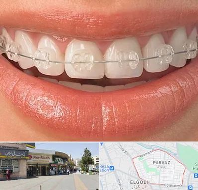 ارتودنسی اقساطی در پرواز تبریز