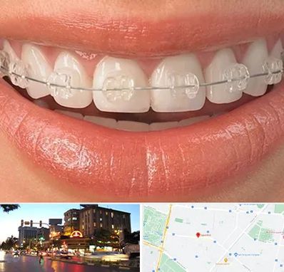 ارتودنسی اقساطی در بلوار سجاد مشهد 