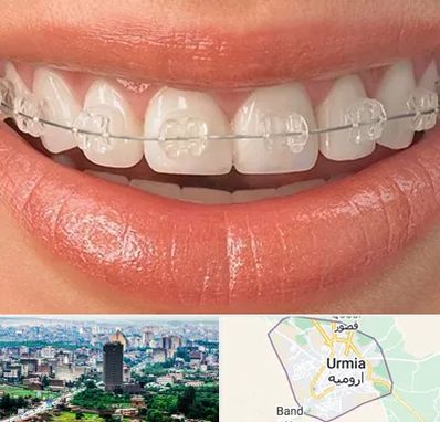 ارتودنسی اقساطی در ارومیه