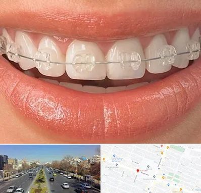 ارتودنسی اقساطی در بلوار معلم مشهد 