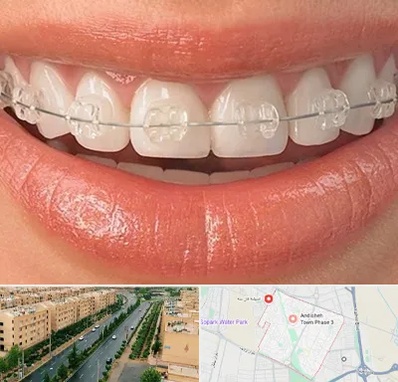 ارتودنسی اقساطی در فاز سه اندیشه