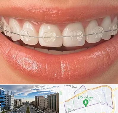 ارتودنسی اقساطی در سعادت آباد 