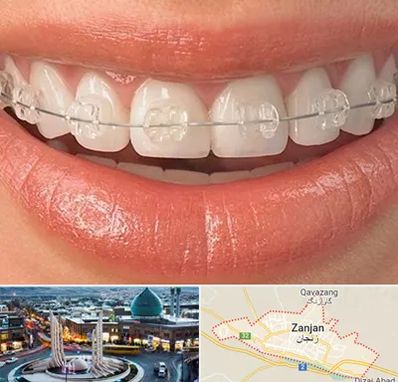 ارتودنسی اقساطی در زنجان