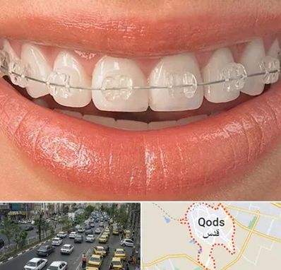 ارتودنسی اقساطی در شهر قدس
