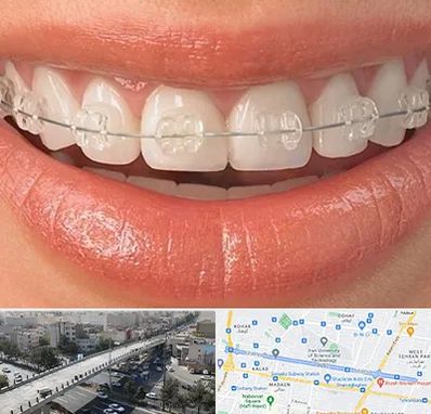 ارتودنسی اقساطی در فرجام 