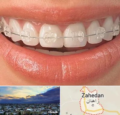 ارتودنسی اقساطی در زاهدان