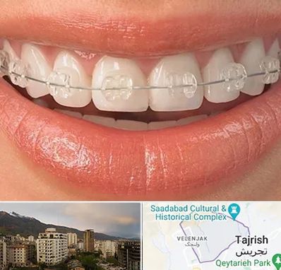 ارتودنسی اقساطی در زعفرانیه 