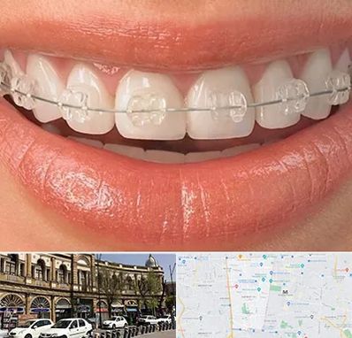 ارتودنسی اقساطی در منطقه 11 تهران 