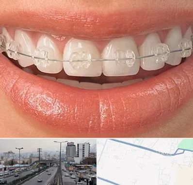 ارتودنسی اقساطی در بلوار ارتش