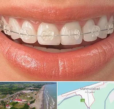 ارتودنسی اقساطی در محمودآباد