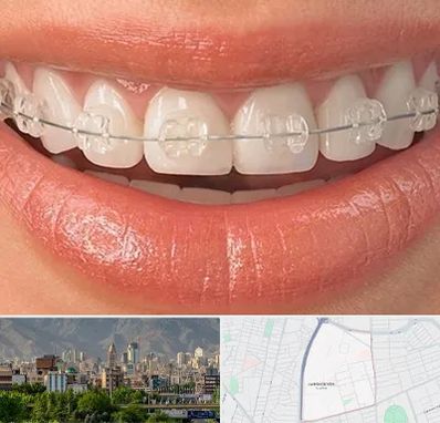 ارتودنسی اقساطی در جمشیدیه