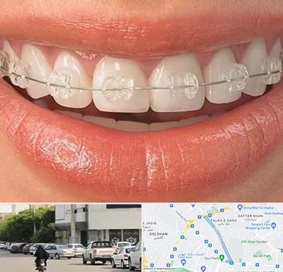 ارتودنسی اقساطی در قدوسی شرقی شیراز 