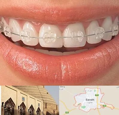 ارتودنسی اقساطی در ساوه