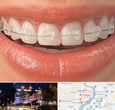 ارتودنسی اقساطی در کیانپارس اهواز 