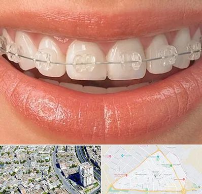 ارتودنسی اقساطی در قاسم آباد مشهد 