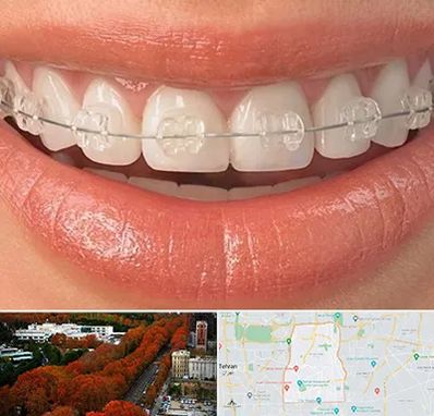 ارتودنسی اقساطی در منطقه 6 تهران 