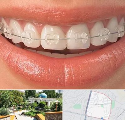 ارتودنسی اقساطی در باغمیشه تبریز