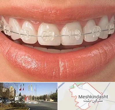 ارتودنسی اقساطی در مشکین دشت