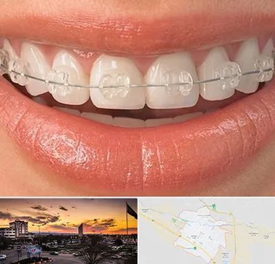 ارتودنسی اقساطی در قوچان