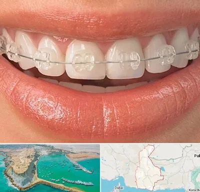 ارتودنسی اقساطی در سیستان و بلوچستان