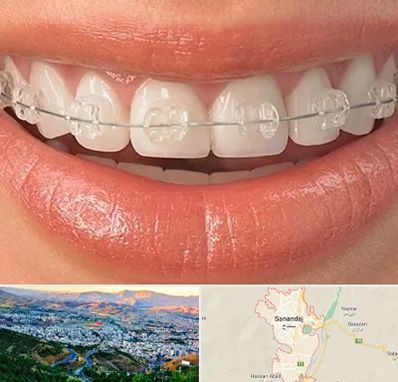 ارتودنسی اقساطی در سنندج